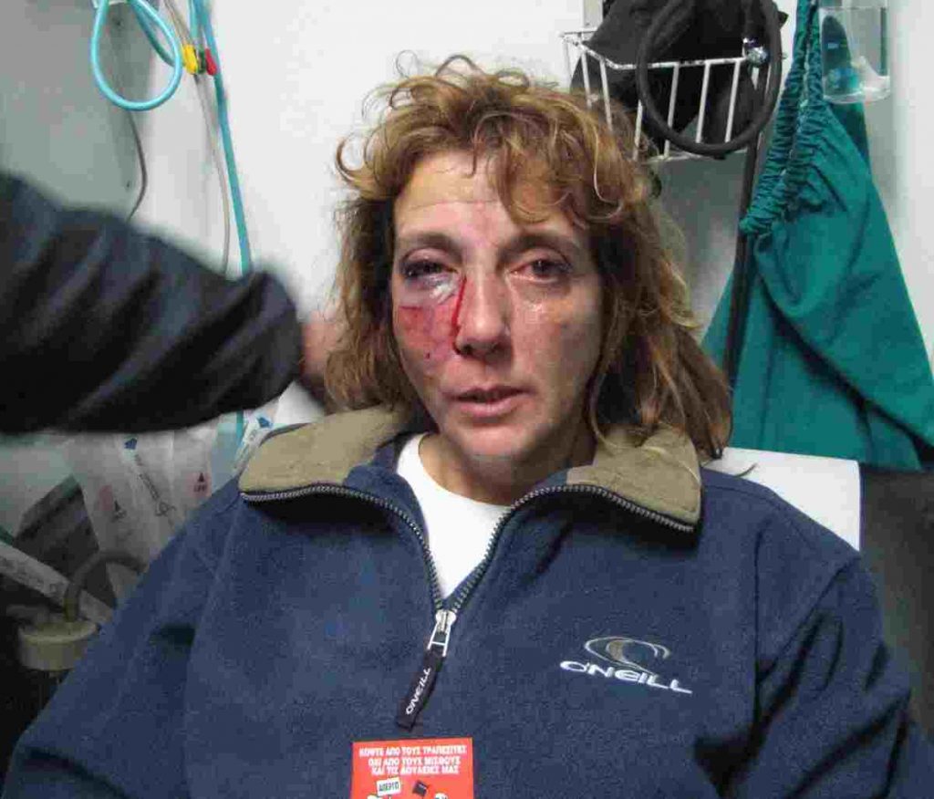 Διαδηλώτρια: Έβλεπα το γκλομπ να πέφτει στο πρόσωπό μου!