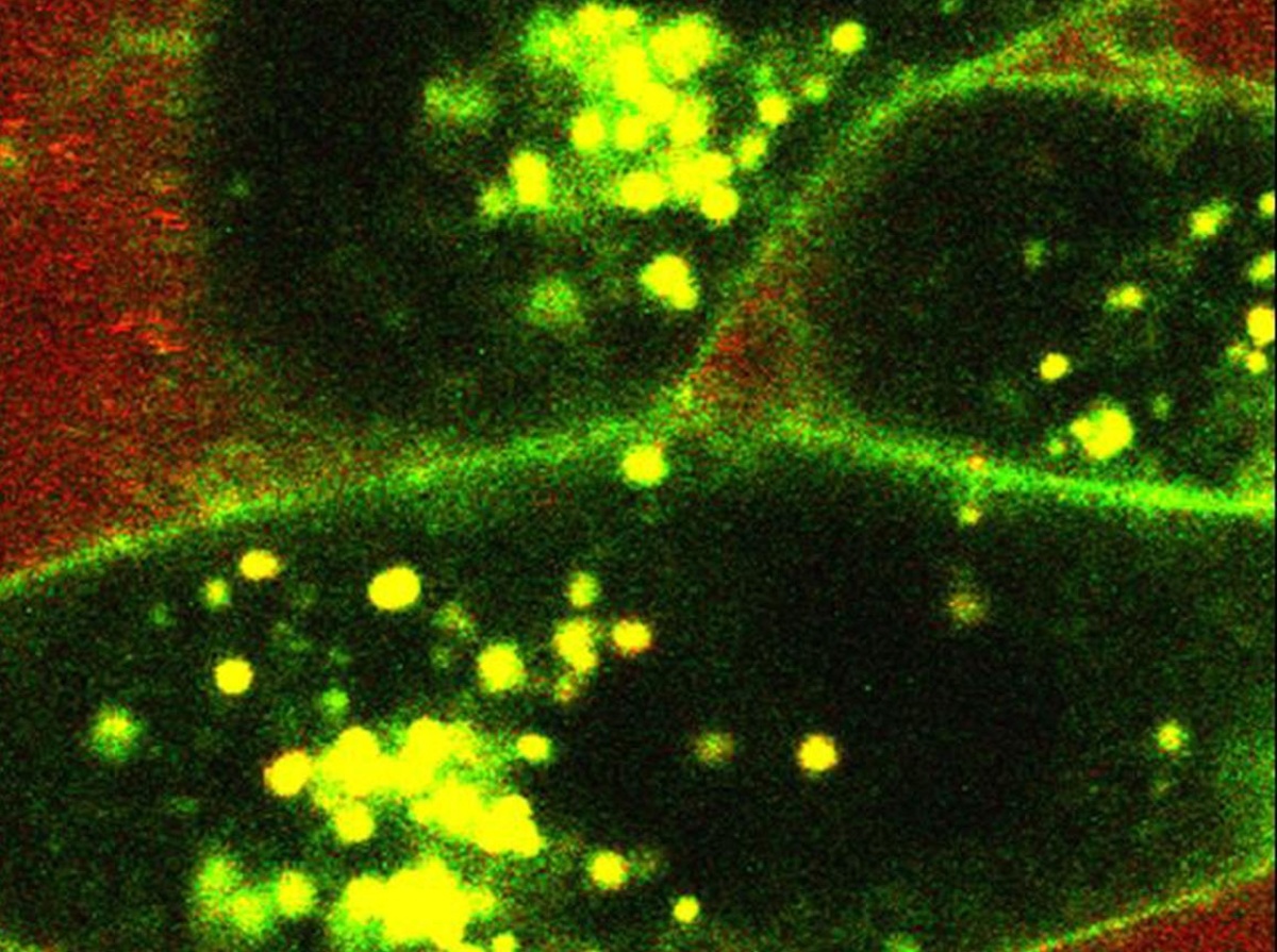 Βρέθηκε ιός που “τρώει” καρκινικά κύταρα!