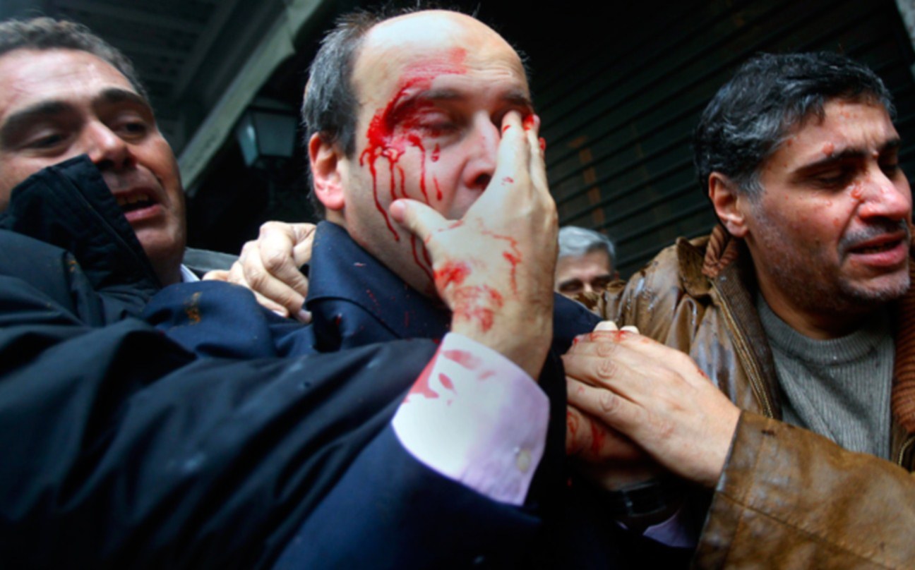 “Ήμουν οργισμένος με τους πολιτικούς” λέει ο 68χρονος που χτύπησε τον Κ.Χατζηδάκη