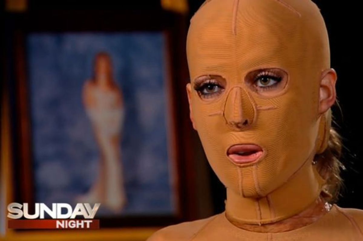 Της έριξε οινόπνευμα και της έβαλε φωτιά – Πώς ήταν και πώς έγινε (ΠΡΟΣΟΧΗ, ΣΚΛΗΡΕΣ ΕΙΚΟΝΕΣ)