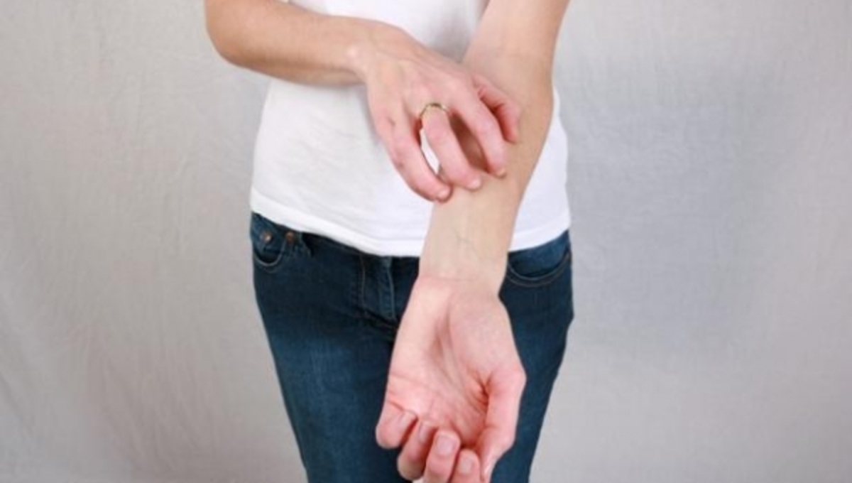 Δερματίτιδα εξ επαφής: Έντονη φαγούρα από υλικά που έχουμε στο σπίτι