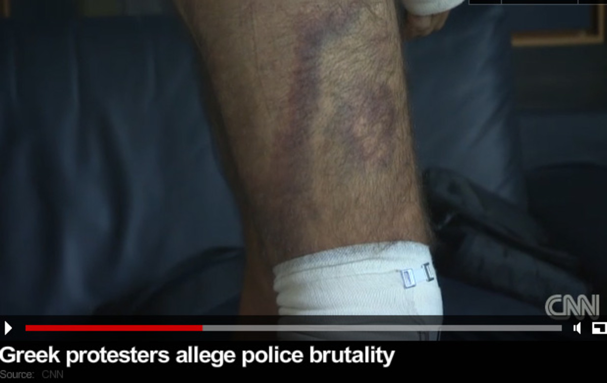 Το CNN κατακεραυνώνει την ΕΛ.ΑΣ για χρήση βίας σε διαδηλωτές! – VIDEO