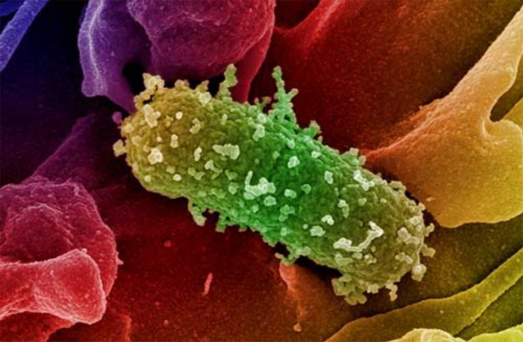Το πρώτο κρούσμα e-coli με τοξικό στέλεχος στα Επτάνησα