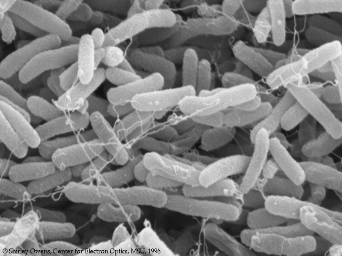 Υποψίες για το βακτήριο E.coli σε προϊόν στην Ελλάδα – Συναγερμός στον ΕΦΕΤ μετά και το μολυσμένο κρέας στα LIdl