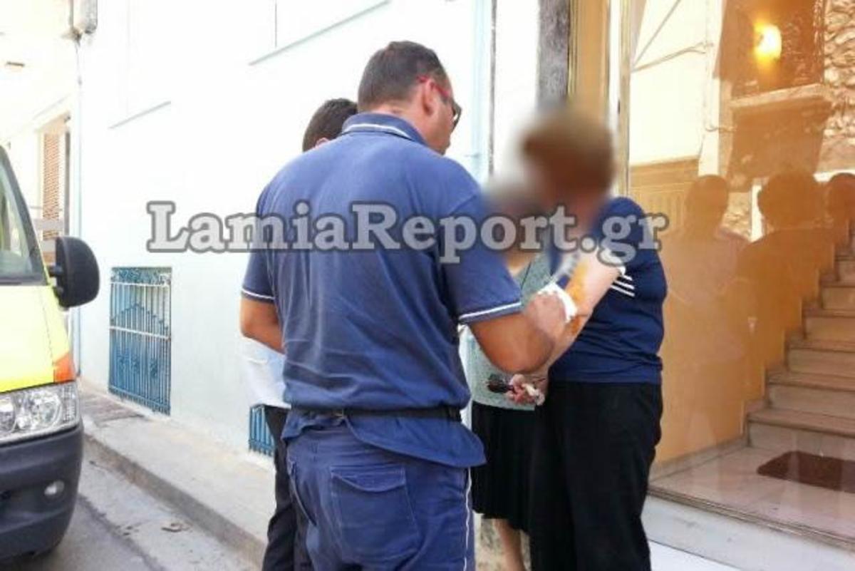 H γυναίκα δείχνει σοκαρισμένη τα τραύματά της - ΦΩΤΟ από το LamiaReport