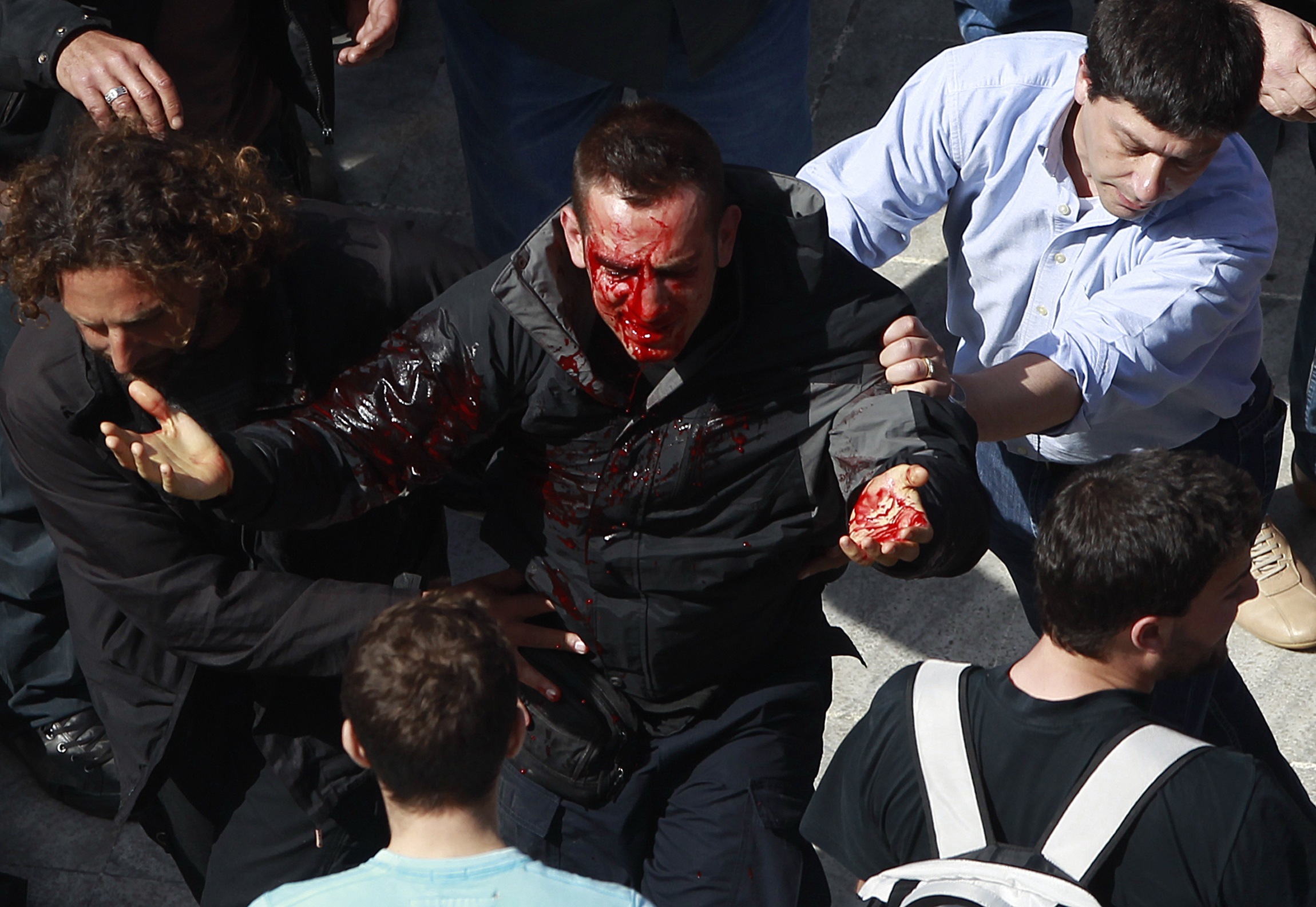 Το Σαββατοκύριακο της τυφλής βίας