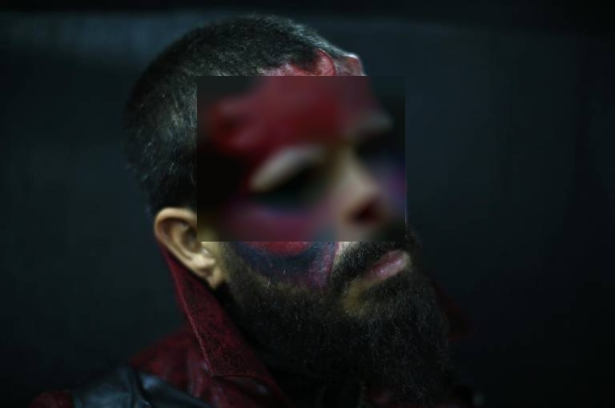 Τρομακτικό! Έκοψε τη μύτη του για να μοιάζει με τον Red Skull του Captain America (ΦΩΤΟ)