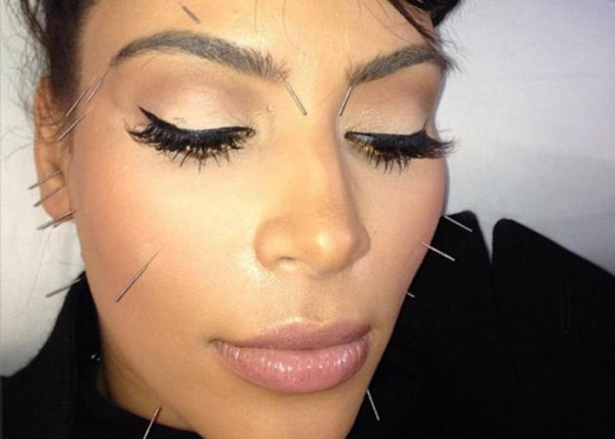 Τι έκανε πάλι στο πρόσωπό της η Kim Kardashian;