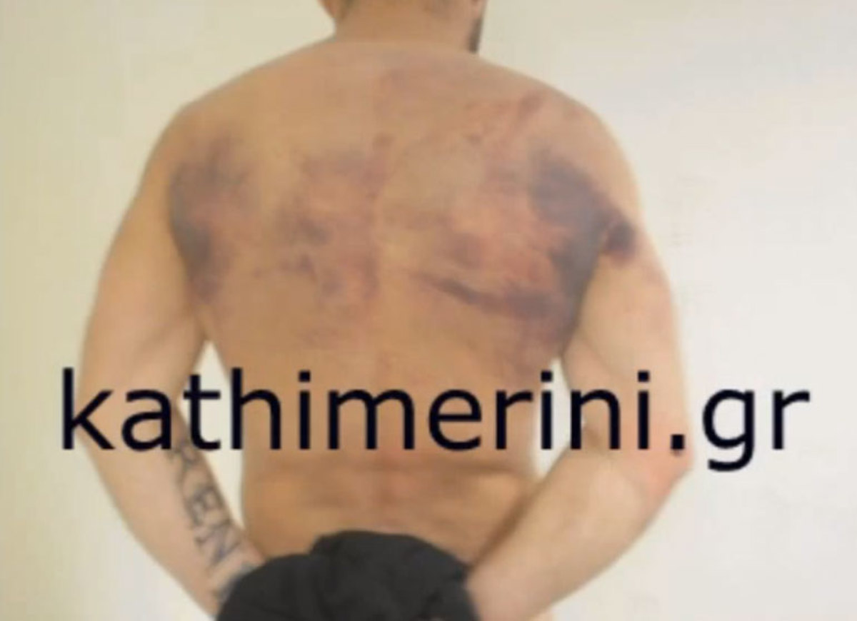 Video ντοκουμέντο: οι τελευταίες ώρες της ζωής του Ιλί Καρέλι – Ο βασανισμός και ο θανατός του στις φυλακές Νιγρίτας