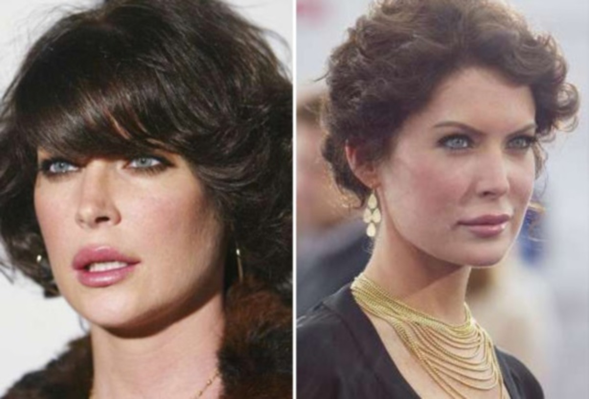 Αγνώριστη από τις πλαστικές η ηθοποιός Lara Flynn Boyle!