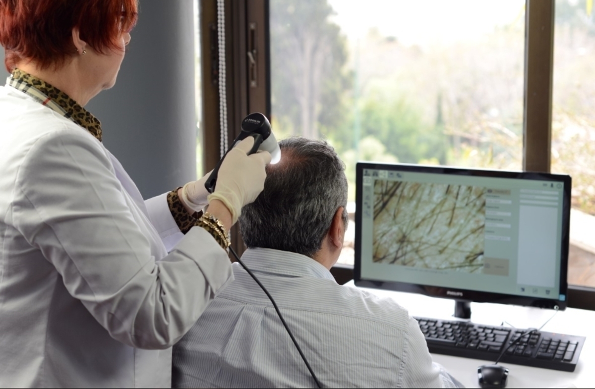 Ποια μέθοδος αποκαλύπτει τον αριθμό των τριχοθυλακίων που επαναφύτρωσαν μετά τη μεταμόσχευση μαλλιών FUE;