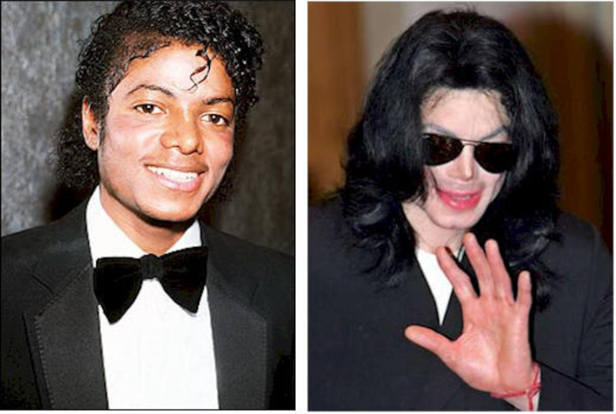 O Michael Jackson δεν άλλαξε το χρώμα του!