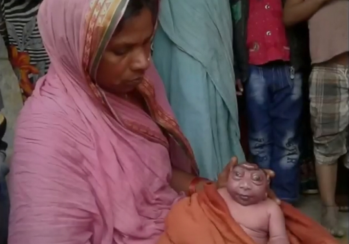 Σοκάρει μητέρα που απορρίπτει το νεογέννητο μωράκι της! “Μοιάζει με εξωγήνιο”!