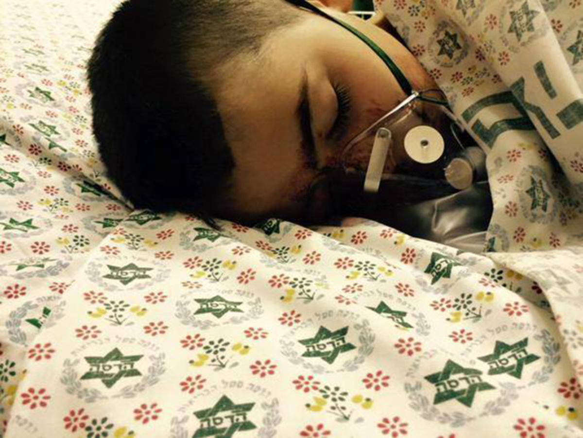 Αστυνομικός πυροβόλησε 5χρονο Παλαιστίνιο στο πρόσωπο (ΣΚΛΗΡΕΣ ΕΙΚΟΝΕΣ)