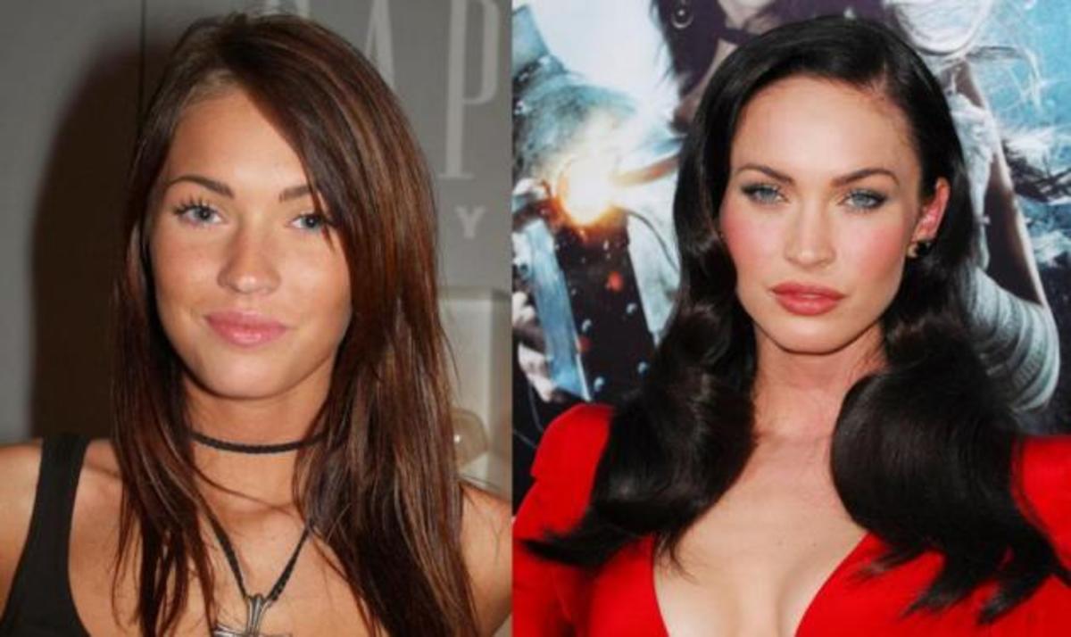 Celebrities πριν και μετά τις πλαστικές επεμβάσεις! ΦΩΤΟ