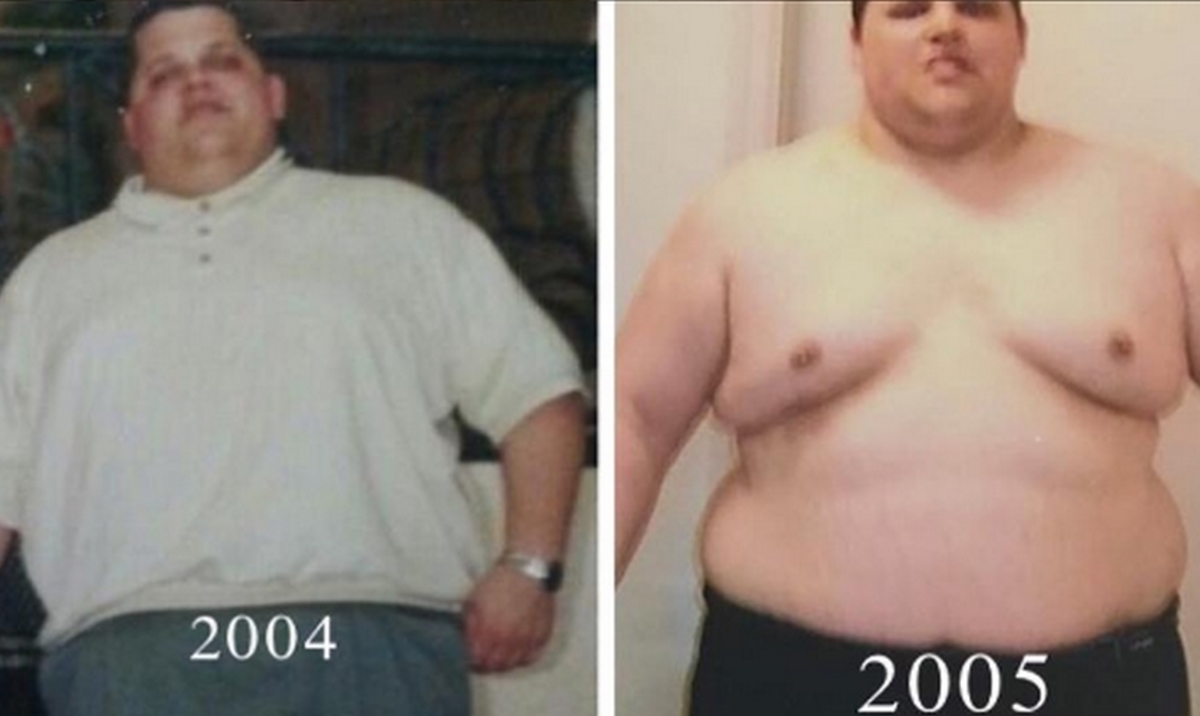 Απίστευτη μεταμόρφωση! Έχασε 89 κιλά σε 10 μήνες – Δείτε την εντυπωσιακή αλλαγή [pics]