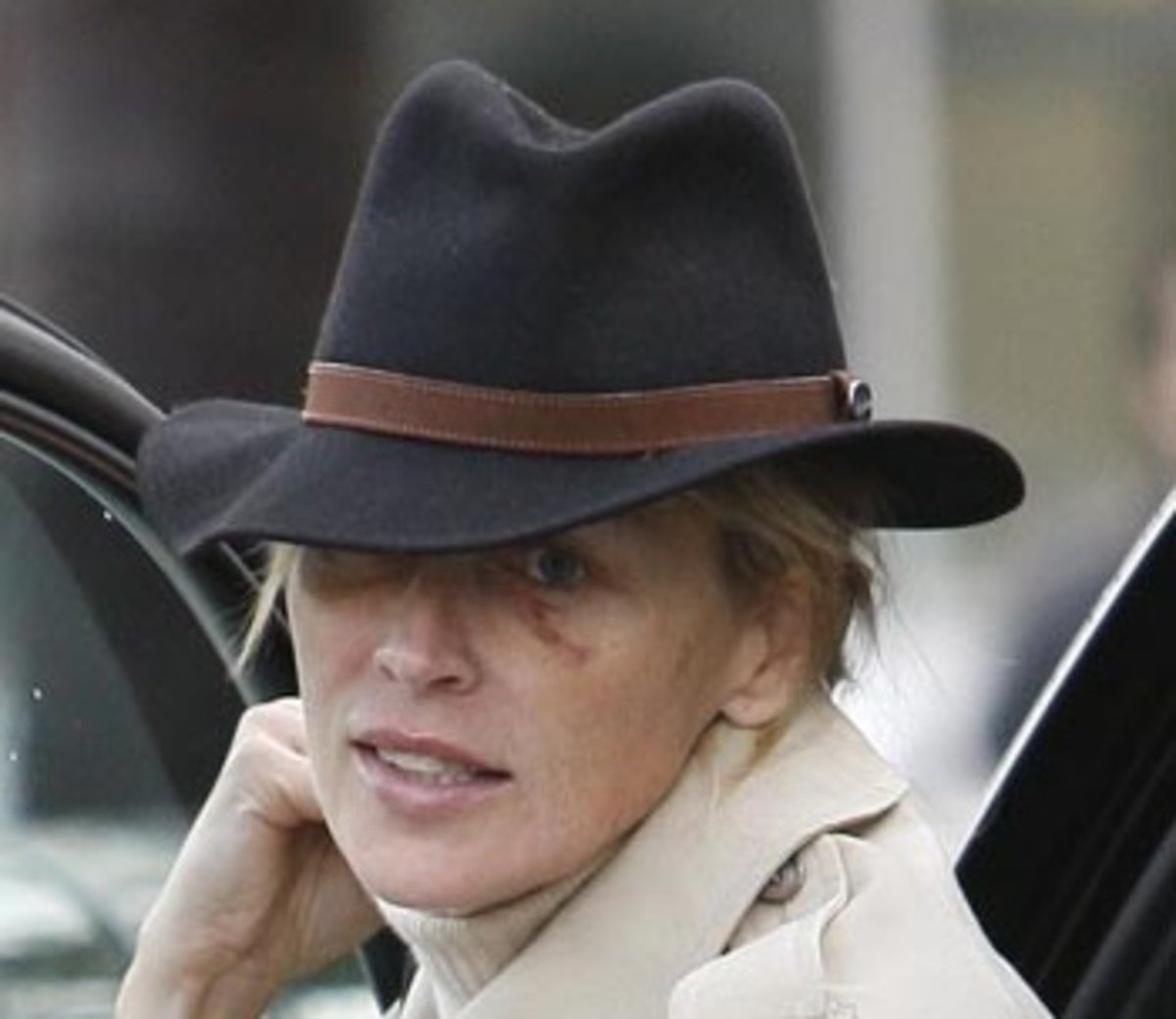 Η Σάρον Στόουν με μελανιασμένα μάτια!