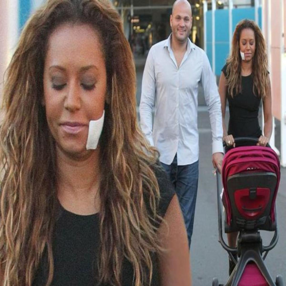 Mel B: Σοκάρουν οι νέες αποκαλύψεις για τον άντρα της : Φερόταν στη νταντά σαν να ήταν γυναίκα του – Φοβάμαι για τη ζωή μου”