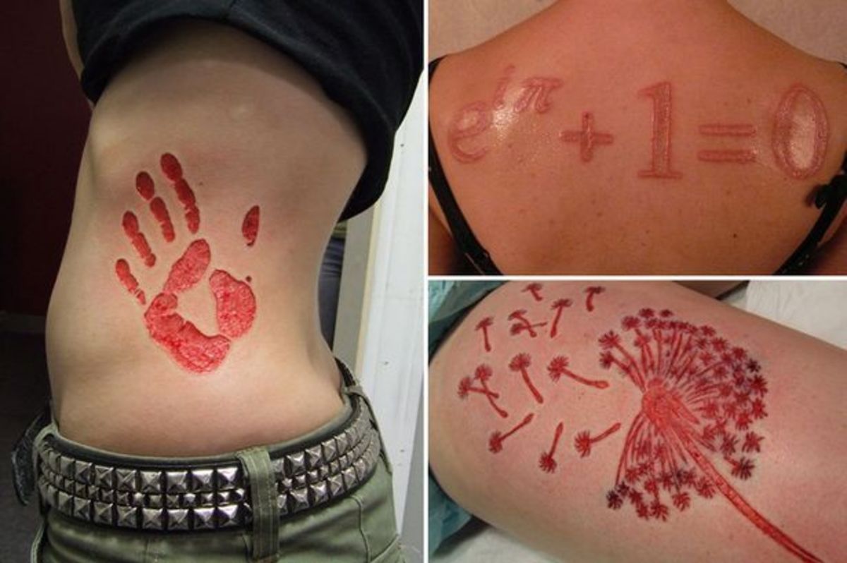 Μόδα φρίκης: Βγάζουν το δέρμα τους αντί για τατουάζ! (ΦΩΤΟ)