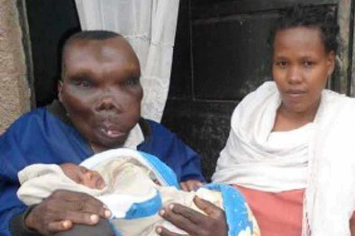 Ξανά πατέρας ο πιο άσχημος άντρας στην Ουγκάντα