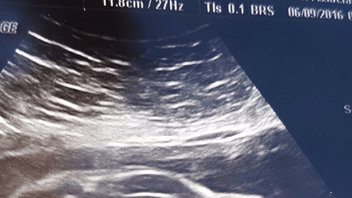 “The Fast and the Fetus”! To υπερηχογράφημα έδειξε.. αυτοκίνητο (ΦΩΤΟ)