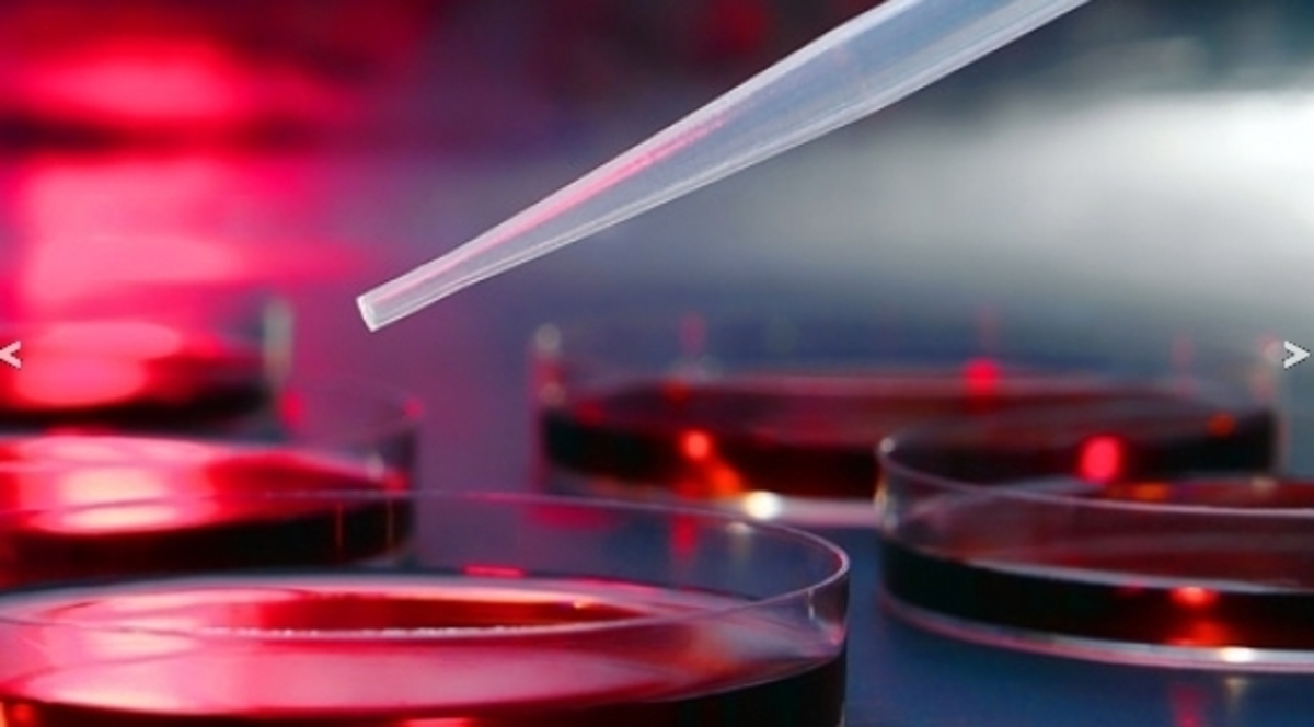 Επανάσταση στην φαρμακευτική αντιμετώπιση της υπερλιπιδαιμίας με “βούλα” του FDA