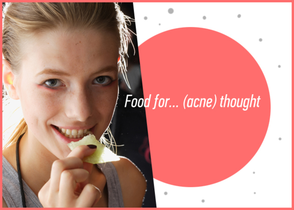 Τι διατροφή να ακολουθήσεις για να μειώσεις τα σημάδια της ακμής