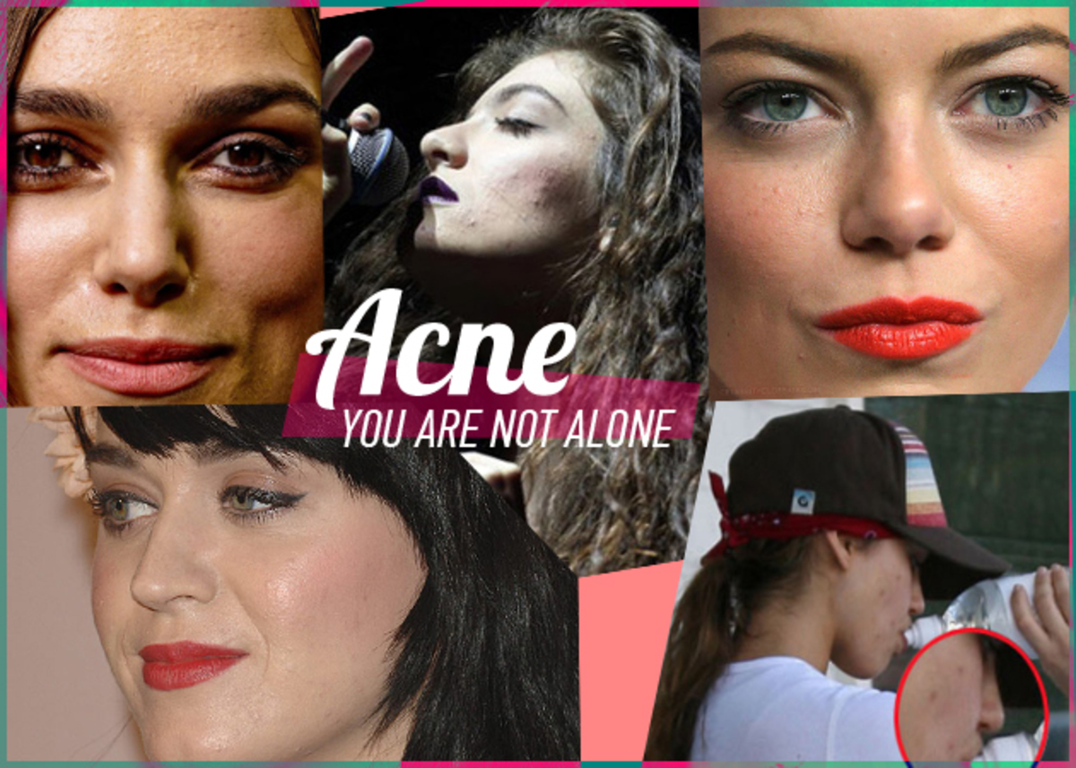 10 stars που έχουν περάσει ακμή!