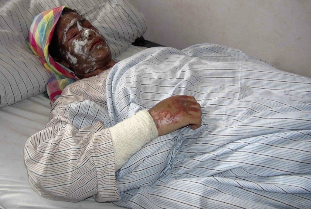 Τους ψέκασαν στο πρόσωπο με οξύ για εκδίκηση! Δείτε συγκλονιστικές φωτό