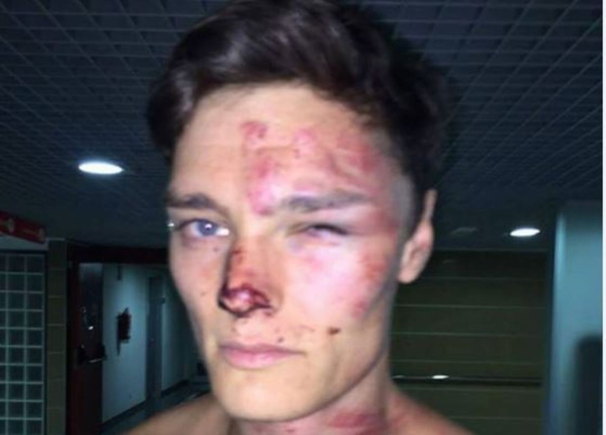 Συγκλονιστικό βίντεο: Σεκιουριτάδες κάνουν “μαύρο” στο ξύλο Άγγλο τουρίστα σε ξενοδοχείο στη Μαγιόρκα – ΦΩΤΟ & ΒΙΝΤΕΟ