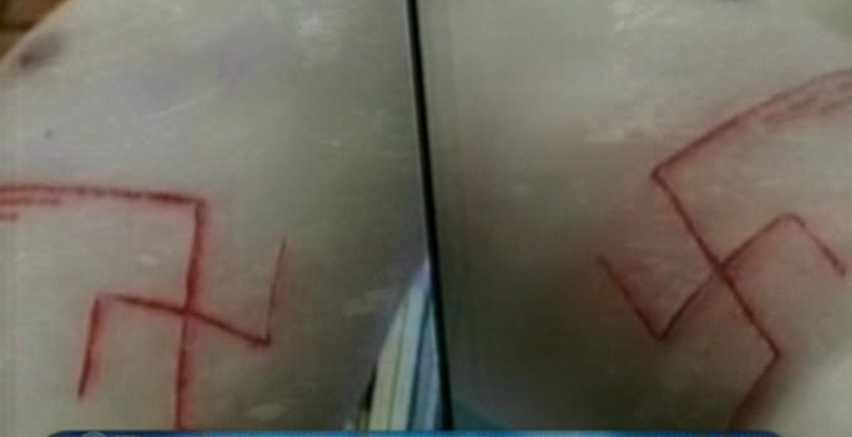 Της χάραξαν στο χέρι αγκυλωτούς σταυρούς