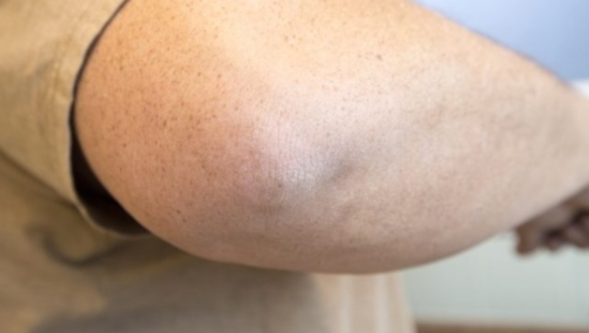 Σκληρό και σκούρο δέρμα στους αγκώνες; Αντιμετωπίστε το σε δύο βήματα