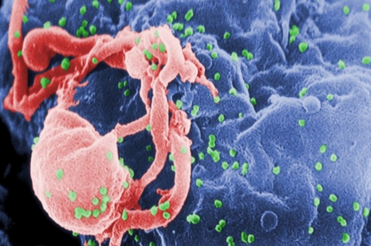 Επτά μύθοι για το AIDS