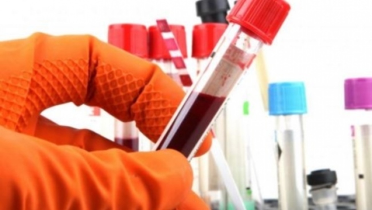 Αιματοκρίτης: Ποιες παθήσεις υποδεικνύουν οι χαμηλές ή οι υψηλές τιμές