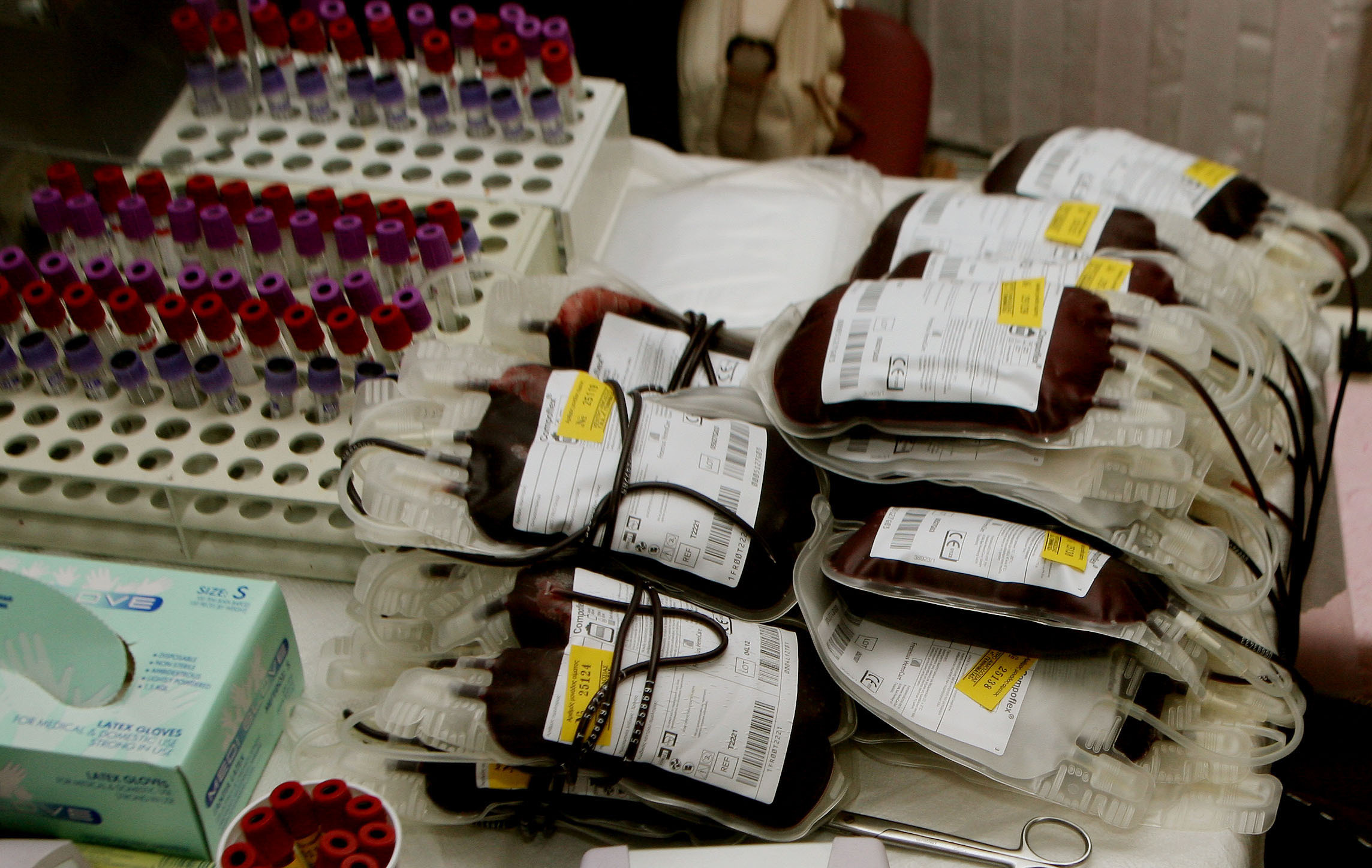 Παιδιά μολύνθηκαν με AIDS μετά από μεταγγίσεις αίματος