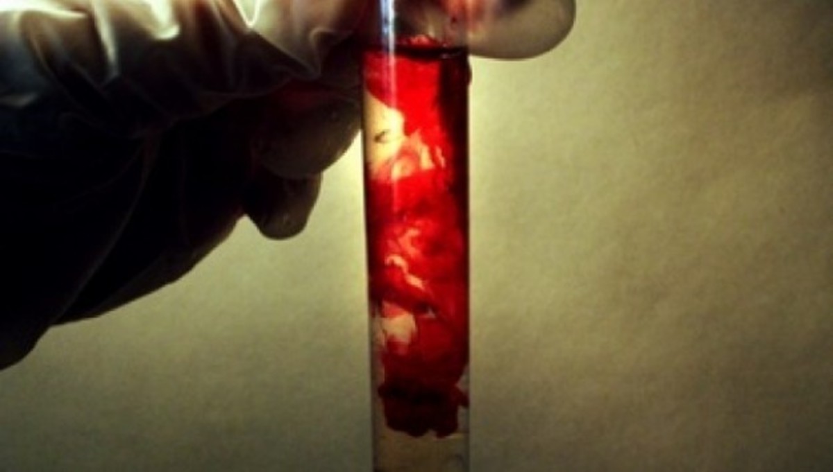 Πάτρα: Σοβαρό επεισόδιο με τα νοσοκομειακά απόβλητα στον “Άγιο Ανδρέα” – “Λούστηκαν” με αίματα και ούρα