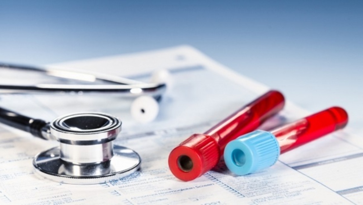 Κάθε πότε πρέπει να κάνετε γενική εξέτση αίματος