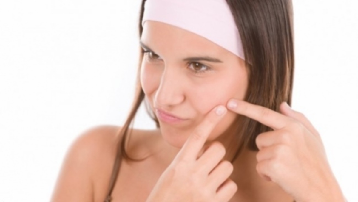 Ακμή: Τι δείχνουν για την υγεία σας τα συγκεκριμένα σημεία που εμφανίζονται σπυράκια