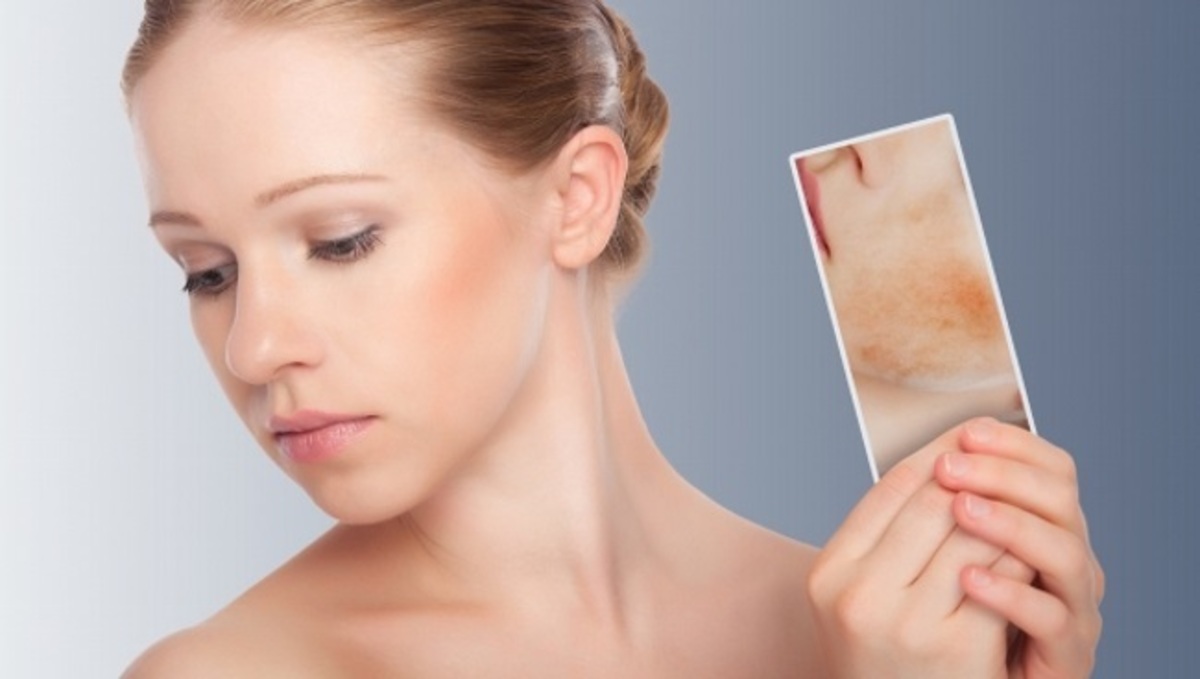 Πότε η απλή φαγούρα είναι σημάδι θυλακίτιδας – Πώς θα το καταλάβετε