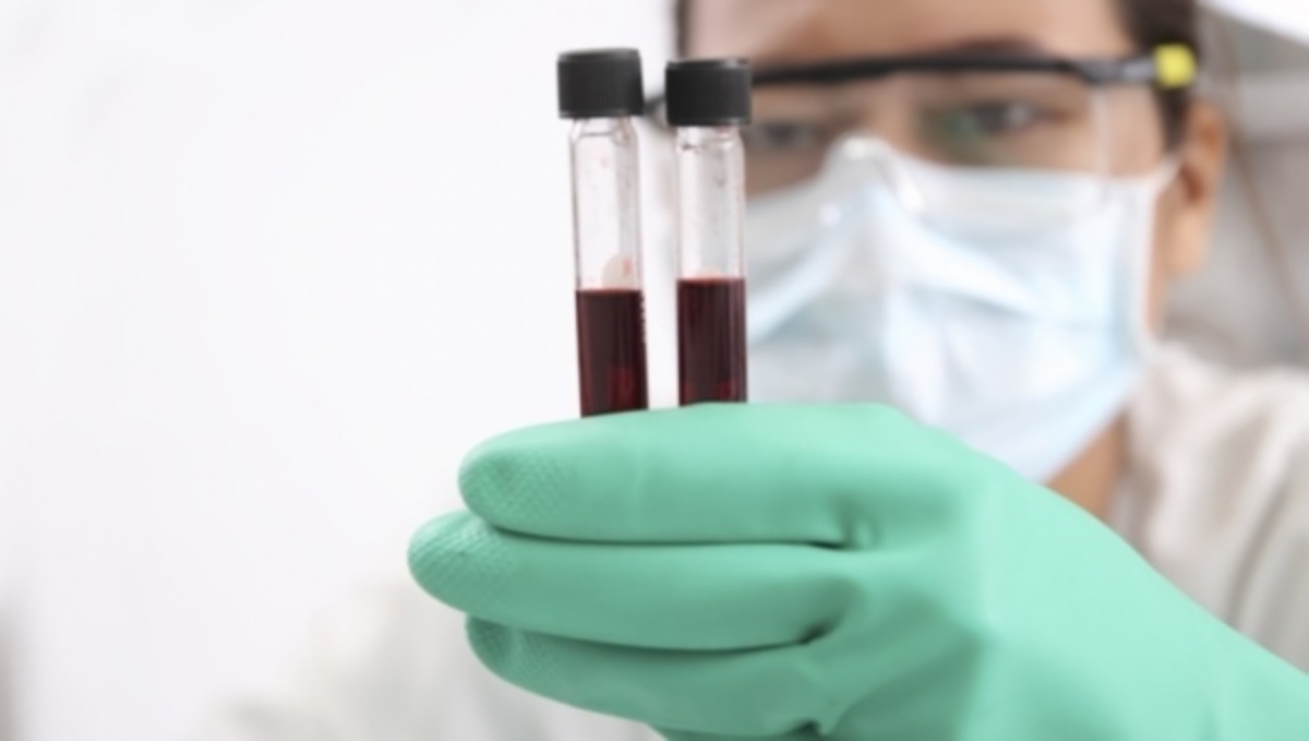 Ανακάλυψαν τεστ αίματος για την πιο έγκαιρη ανίχνευση του Αλτσχάιμερ που έγινε ποτέ