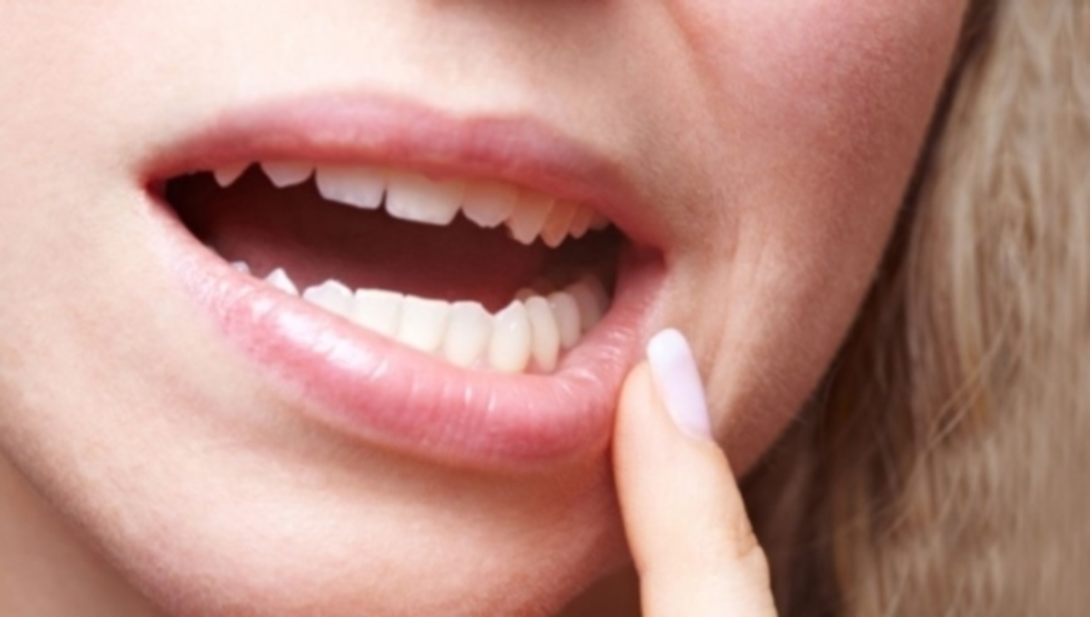 Πονάνε τα ούλα σας; Δείτε πώς θα βρείτε ανακούφιση…
