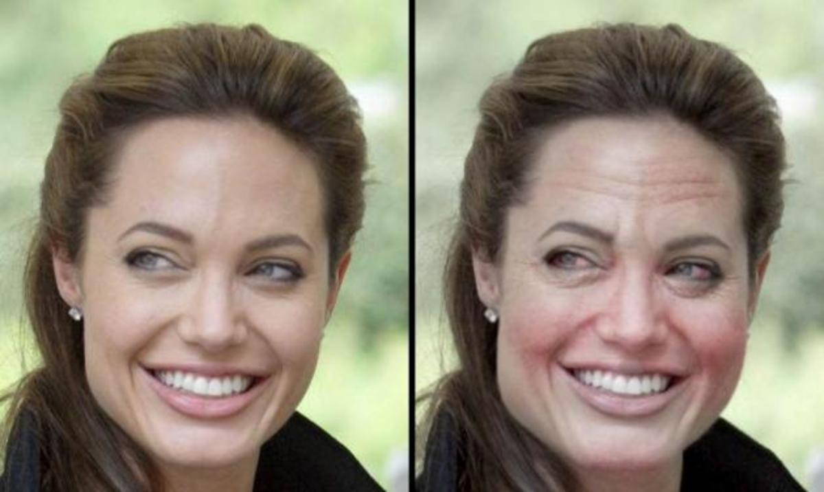 Α. Jolie, Madonna, D.Beckham: Δες πως θα είναι σε 10 χρόνια αν αρχίσουν το ποτό!