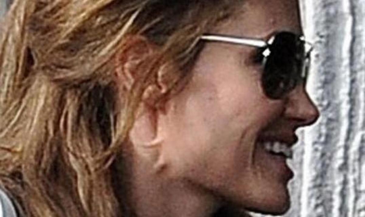Τι συμβαίνει με το λαιμό της Jolie στη φωτογραφία;