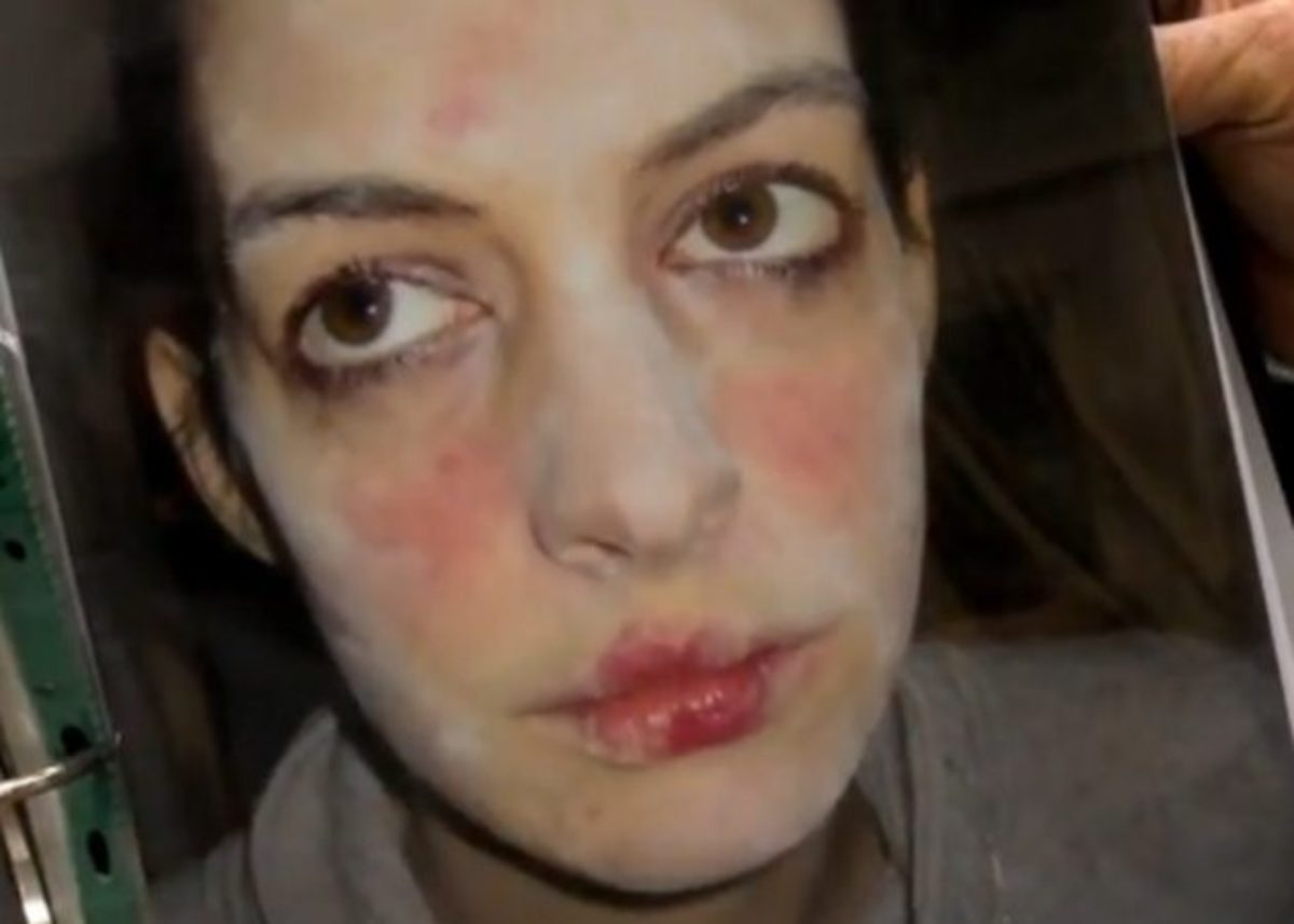 Αυτό θα πει μεταμόρφωση! Δες το backstage video από το μακιγιάζ της A. Hathaway στο Les Miserables!