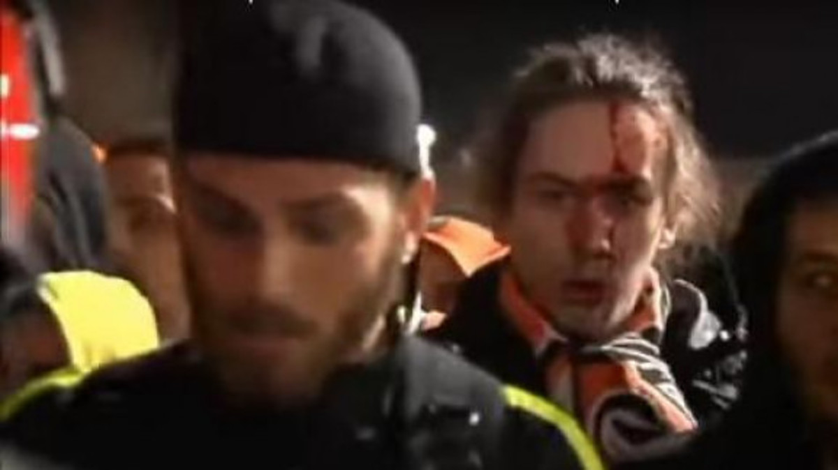 Σοβαρά επεισόδια στο Μπιλμπάο – ΑΠΟΕΛ! Άγριο ξύλο με τραυματίες [vid]