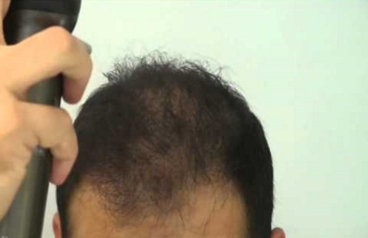 «Βάζω στα μαλλιά μου αυτό το ειδικό που είναι σαν σκόνη για να μη φαίνεται από τους προβολείς το αραίωμα»!