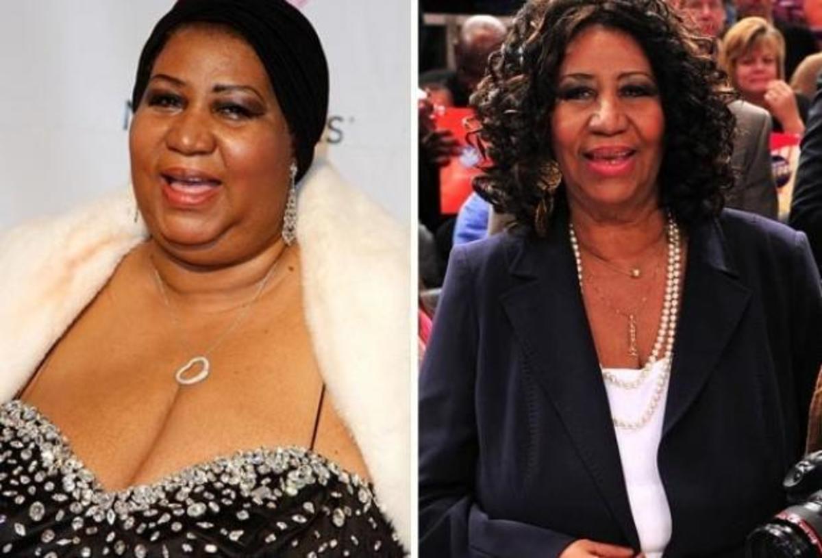 Celebrities που έχασαν κιλά και κέρδισαν… τις εντυπώσεις