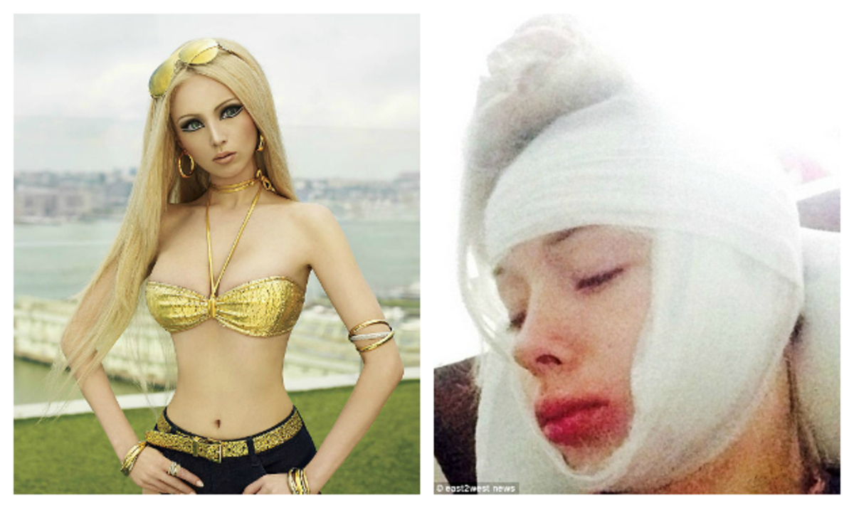 Ποιος έσπασε στο ξύλο τη ζωντανή Barbie;