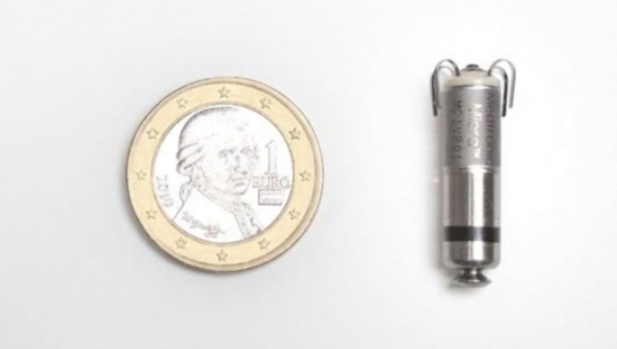 Πρωτοποριακή επέμβαση στην Ελλάδα – Δείτε το νέο βηματοδότη σε μέγεθος… χαπιού