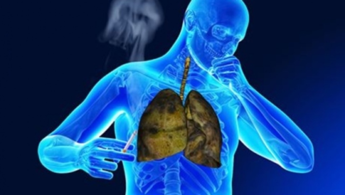 Πώς θα σταματήσετε τον ενοχλητικό τσιγαρόβηχα